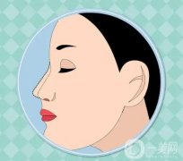 鼻綜合感染的應(yīng)對與預(yù)防措施