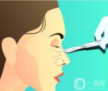 鼻翼縮小的后遺癥及怎么避免