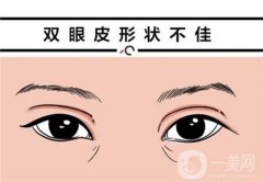 臥蠶可以通過手術(shù)實現(xiàn)嗎