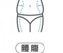 吸脂后是否會反彈？