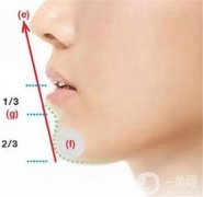 下巴注射玻尿酸后如何快速恢復(fù)呢？