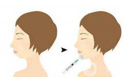 下巴注射玻尿酸后為什么會出現(xiàn)硬塊呢？