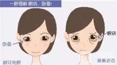眼袋修復(fù)的方法有哪些？