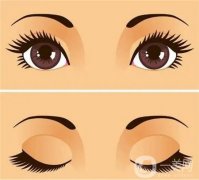眼窩填充是否需要手術(shù)呢？