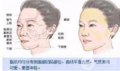 自體脂肪豐臉的特點
