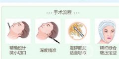 面部能否進行水動力吸脂？安全性如何？