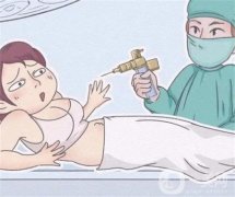 哪些人群應(yīng)避免注射溶脂針呢？