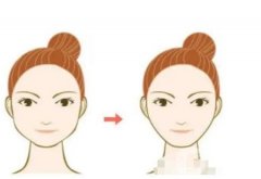 切骨手術(shù)怎么樣，有潛在風(fēng)險(xiǎn)嗎