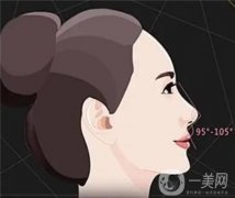 膨體進(jìn)口與國產(chǎn)的差異是什么