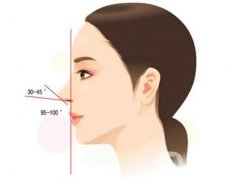 膨體隆鼻后取出是否真的困難？