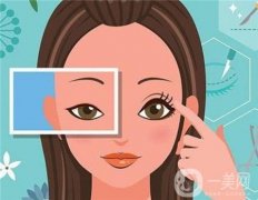 全切雙眼皮后增生該如何處理呢？