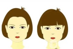 顴骨墊高手術的效果如何，恢復時間長嗎