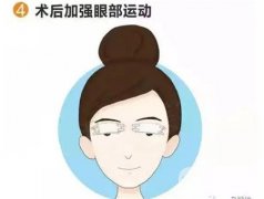 如何有效地上瞼下垂