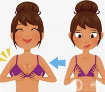 乳暈縮小手術(shù)的效果如何呢？