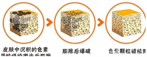 天津醫(yī)科大學(xué)腫瘤醫(yī)院整形科價格表，附激光祛斑恢復(fù)果圖